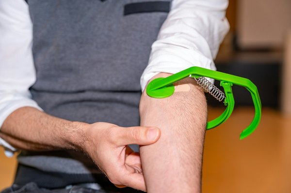 Embolisation : une alternative non invasive à la chirurgie